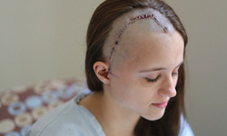 恐怖情人埋伏攻擊　正妹頭留巨疤逃死劫 恐怖情人、攻擊、分手、持刀、傻眼