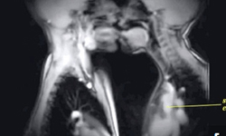 最「赤裸」的性愛畫面 核磁共振視角超衝擊！ 私話題、核磁共振、MRI、性愛、健康教育、輻射