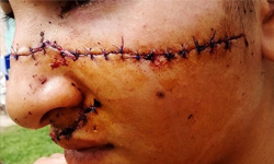 妹貌美，姊嫉恨！割臉毀容成「恰吉」警不理 鬼娃、恰吉、裂嘴女、魔鏡、恐怖、暴力、流血、血腥、女性、女孩、女子、毀容、姊妹、嫉妒、美貌、恐怖片、恐怖、電影、角色、Julia Alvarez、YeniAlvarez