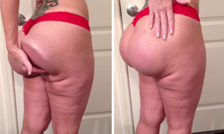 這種翹臀，我不行　脫衣舞孃豐臀變屁股內建坐墊 整形、豐臀、屁股、屁屁、翹臀