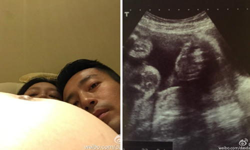 妞快報：大S曬男娃孕肚照！網友調侃：「小S哭暈在廁所！」 妞快報、大S、男娃、孕肚、汪小菲