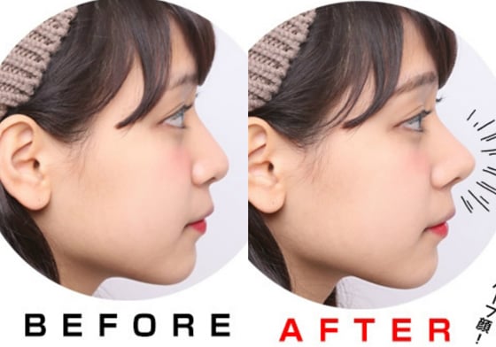 1秒擁有高挺鼻！日本超夯的鼻子增高器讓你跟整型手術說掰掰 日本、美容、神器、美妝、鼻子