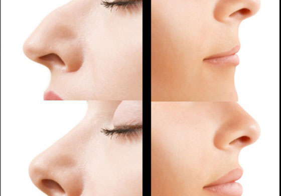 5/23限時免費App特輯：堪稱醫美等級的詐欺修圖App實現你想瘦的願望！ 限免、免費、特價、iPhone、App