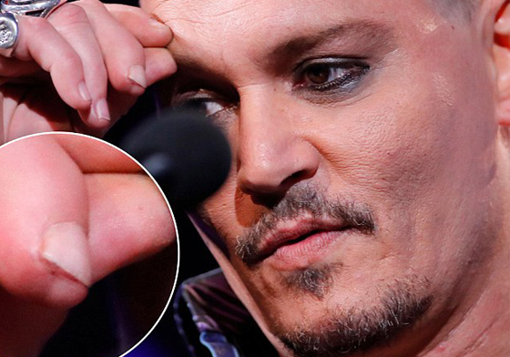 妞快報：家暴話題延燒！但這次居然是強尼戴普受傷 強尼戴普、Johnny Depp、安柏赫德、Amber Heard、家暴