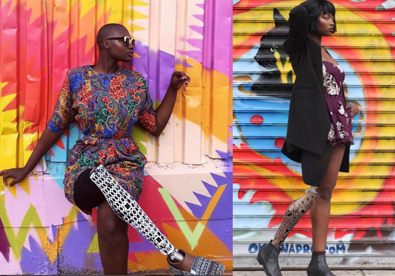 義肢也能成為超Fashion的配件！少女戰勝癌症後變身時尚部落客 Cax、癌症、截肢、自信、魅力