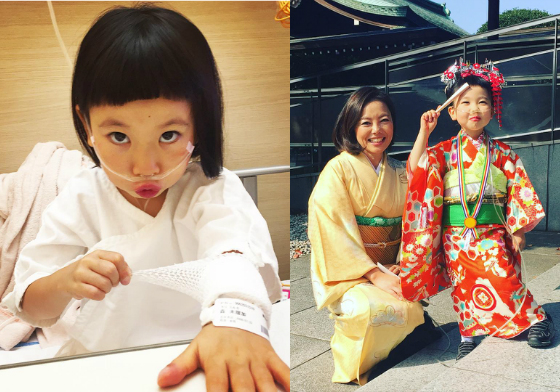 罕病也阻止不了她滿滿的正能量！她就是戴著氧氣管真人版奈良美智女孩 Milka、Yuki、milkayuki、正能量、肺高壓症