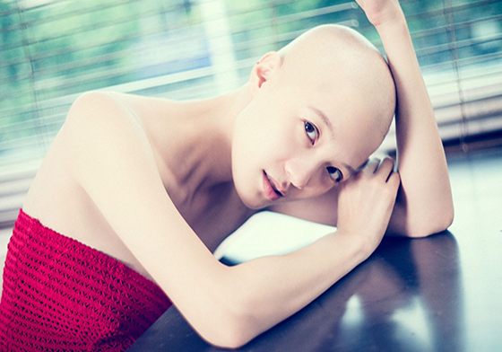 妞專訪：勇敢女生吳娮翎Avis「癌症讓我學會了生命中的無所畏懼！」 乳癌、癌症、勇敢、吳娮翎Avis、化療