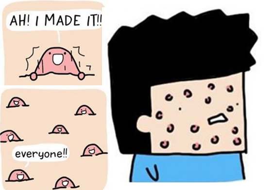 痘痘也是很努力才冒出來的啊～一看就上癮的四格漫畫 插畫、漫畫、4格漫畫、可愛、溫馨、驚喜、出乎意料、thesquarecomics、Alvin Juano、藝術