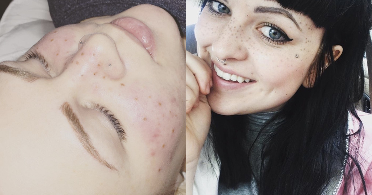 原來不完美才是真流行？歐美少女都在瘋的雀斑刺青 雀斑刺青、雀斑妝、流行、趨勢、小清新