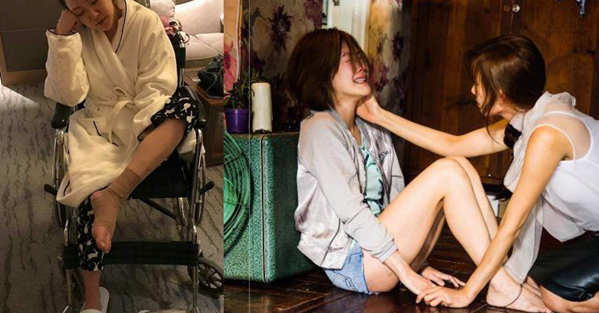 《吃吃的愛》女主角先「痴痴地摔」？小S仆街摔傷坐輪椅 吃吃的愛、小S、林志玲、蔡康永、諧星