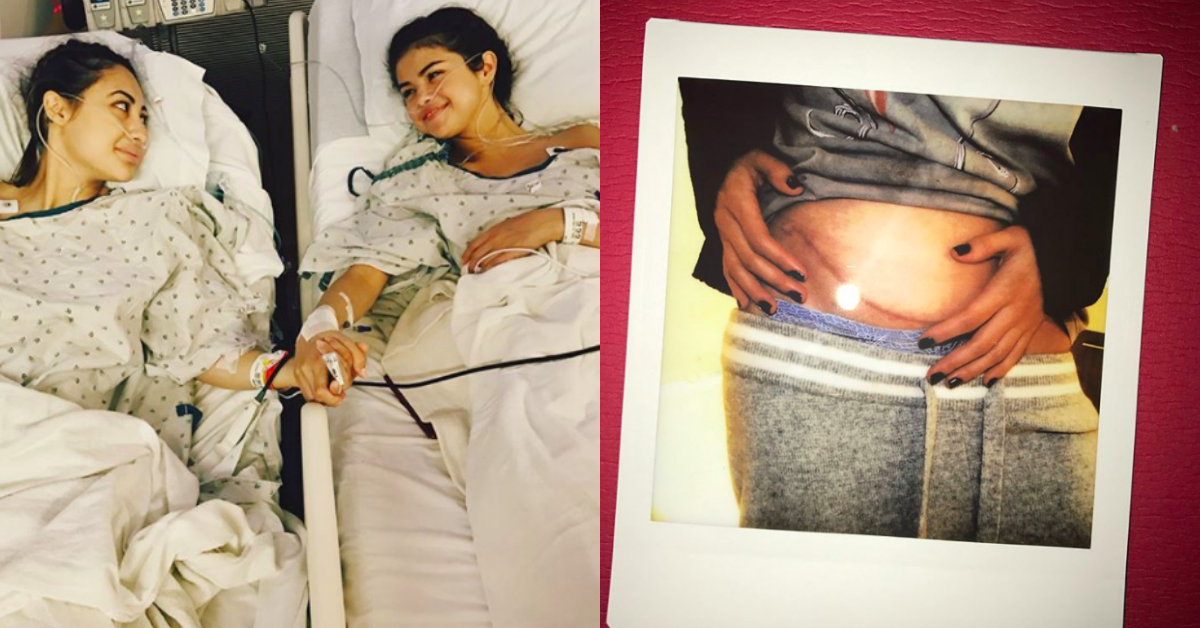 賽琳娜紅斑性狼瘡復發！PO文再三感激好閨蜜捐腎救命 賽琳娜、紅斑性狼瘡、好閨蜜、好姐妹、捐腎、法蘭西亞、Francia Raisa