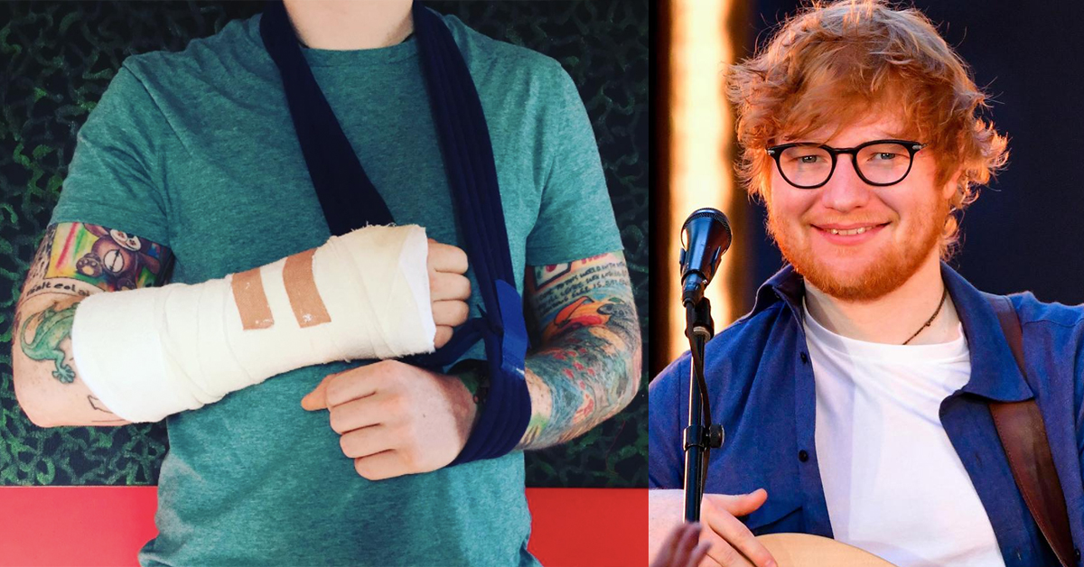 紅髮艾德出車禍！本週日台北演唱會可能取消？ 紅髮艾德、Ed Sheeran、演唱會、南港展覽館、變數