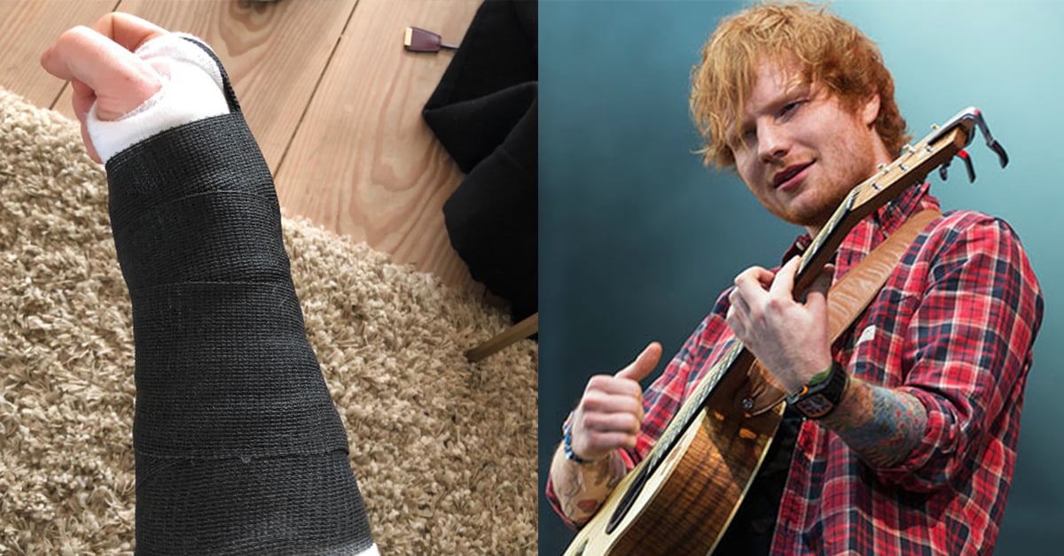 紅髮艾德台灣演唱會確定延期！粉絲崩潰：「肇事司機應該要面壁」 紅髮艾德、車禍、演唱會、延期、台北、Ed Sheeran