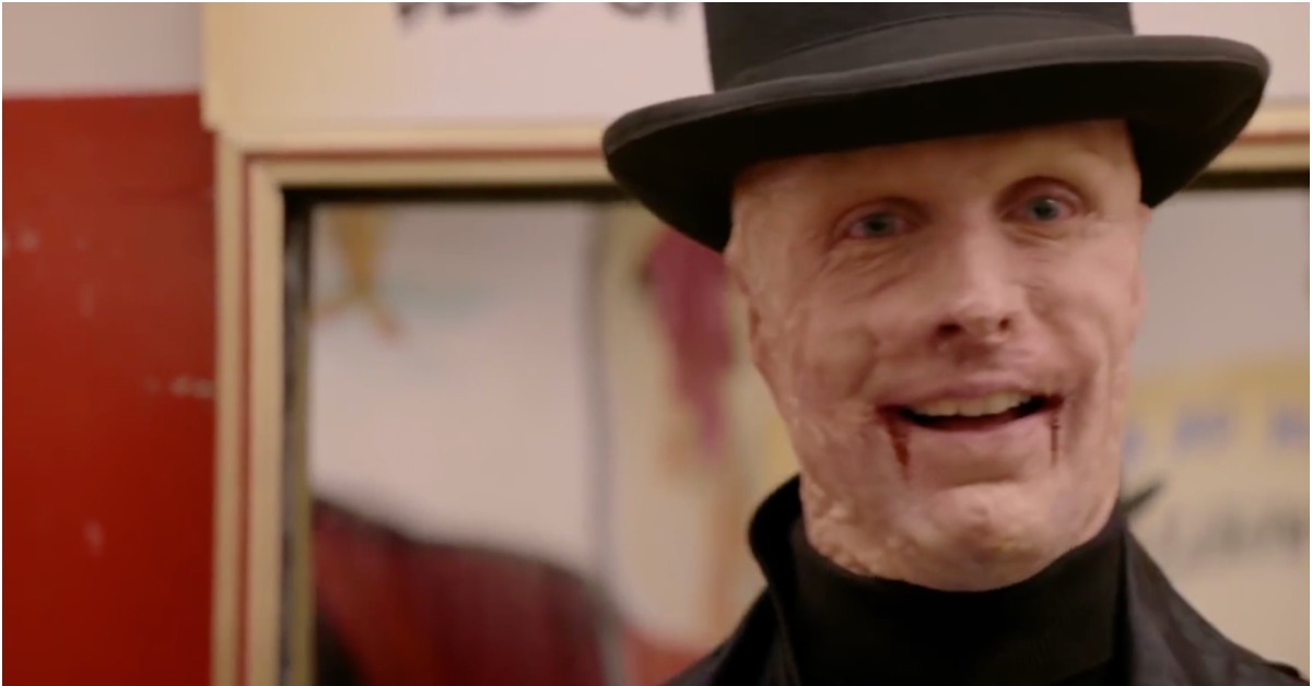 一年之中只有這一天，他像個人 燒傷、燙傷、笑容、正常人、萬聖節