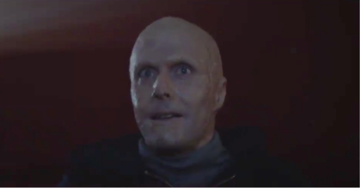 只有活在黑暗之中，我才能無拘無束 法國廣告、燒燙傷、患者、燒燙傷患者、包容、