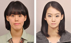 整形帝國不能亡！奇蹟大變身之南韓整形真實案例 Before&After、整形、南韓、神奇