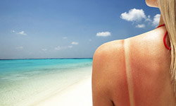 事出必有因　搞懂妳的壞皮膚哪裡來的 皮膚、痘痘、斑點、黑眼圈、保養