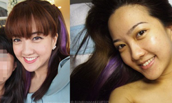 保養警世錄：近乎毀容的做臉過敏實例 醫美、做臉、部落客