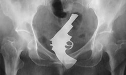 亂塞可是會受傷的！20張超誇張直腸異物X光圖 下體、誇張、X光圖、異物、照片