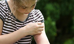 夏日驅蚊大法  拒當「紅豆冰」女孩  夏天、蚊香、止癢、防蚊、驅蚊