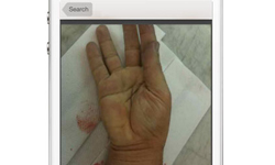 超真實臨床照片 醫界的Instagram《Figure 1.》 Figure 1.、app、醫生、護士、instagram、臨床、病例、照片