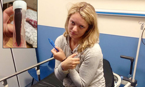 正妹鼻血流不停　鼻腔內藏7.5公分肥蛭蠕動 紀念品、深刻、身刻、恐怖、旅遊