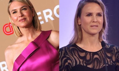 妞快報：「我很高興大家說我變了」芮妮齊維格回應變臉說 妞快報、芮妮齊維格、整形、Doyle Bramhall II