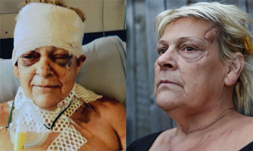 夫妻一場從相愛到互憎　家暴3日到瀕死只因... 老夫老妻、傷害、斧頭、血流不止、英國