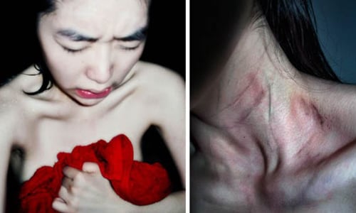 自殘是一種行為藝術？女攝影師赤裸血腥自拍照 Zhe Chen、陳哲、The Bearable、攝影、自殘