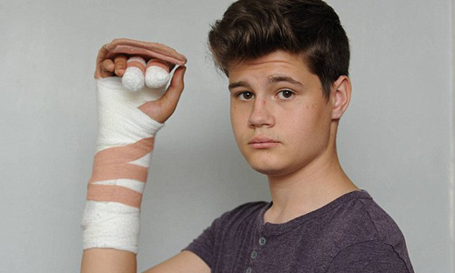 浪漫炮變血肉炮！少年房內點煙火失敗、手炸爛 情侶、小情侶、浪漫、歡心、鞭炮、煙火、室內、房間、意外、炸爛、受傷、年輕、衝動、手術、骨折、危險