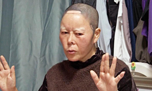 整形整到不成人形...毀容南韓女怒控黑心醫 南韓、整形、天堂、地獄、手術、失敗、良莠不齊、黑心醫生、毀容、離婚、失業、獨居、委屈、砸重金、後悔、控告