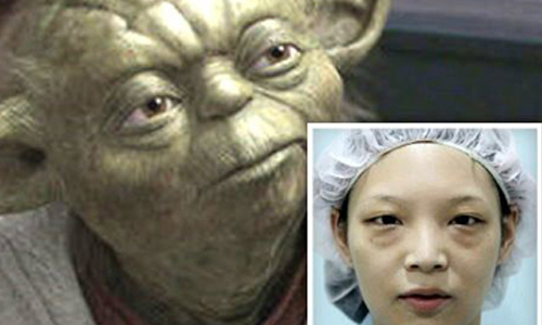 解決眼袋問題！內開手術正興起 健康醫療網、眼袋、眼部、美容、內開法、外開法