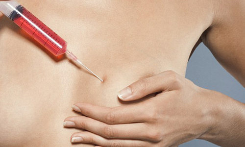 陽光、沙灘、假奶一對！「假期隆乳」讓妳短暫升級、挺胸度假去 度假、享受、假期、增加自信、短期、隆乳、手術、鹽水、注射、短暫、風險、危險、肺部、穿刺、感染、抬頭挺胸、豔遇、美好回憶、自卑、性感