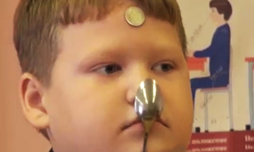 萬磁王真人版？12歲男童被電後成人肉磁鐵 超級英雄、英雄、超能力、萬磁王、X戰警