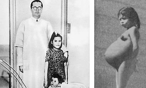 5歲就生下第一胎？人類史上最年輕的產婦—琳娜梅迪娜Lina Medina 出生、產婦、最年輕、年輕、超早熟