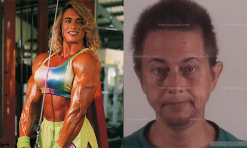 昔日健美小姐變成大叔！9張照片證明類固醇成癮有多可怕  類固醇、健美小姐、過量、攝取、驚人