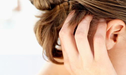 為什麼你的頭總是皮在癢？和頂上困擾告別的7個須知 頭皮癢、脂漏性皮膚炎、頭皮屑、跳蚤、醫師