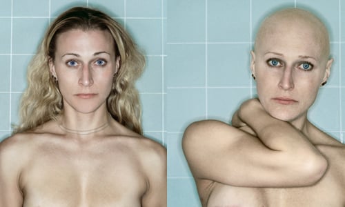 不是人人都願意這樣露奶！乳癌女攝影師的切乳重建紀實 Kerry Mansfield、露奶、上空、手術、攝影