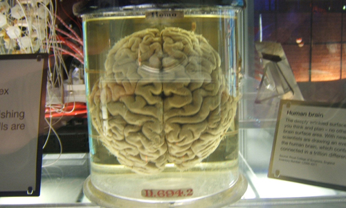 殺人犯的腦也在其中　美大學近百大腦標本不知去向 大腦、偷竊、案件、美國、標本