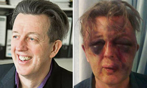 富爸爸在自宅差點被打瞎　英勇女兒救全家 英國、男子、男性、皇室、愛德華、威廉、王子、倫敦、豪宅、自家、自宅、女兒、警報、監視、錄影、鼻青臉腫、豬頭、恐怖、犯罪、暴力、波蘭、波蘭裔、Paul Kohler