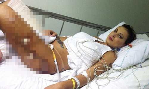 為了當美尻小姐注射填臀　正妹長腿腐蝕後全是洞 Andressa Urach、巴西、模特兒、女模、火辣