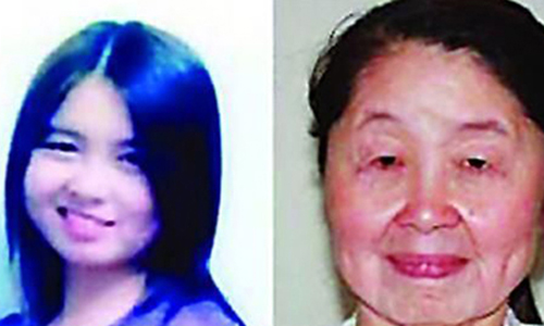 你相信她只有28歲嗎？少婦產後衰老成老奶奶 皮膚鬆弛、老化、嚴重、年輕、奶奶