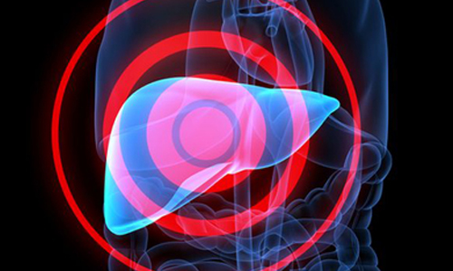 缺鐵補鐵無效？吃多小心肝功能異常！ 健康醫療網、貧血、鐵劑、缺鐵補鐵、海洋性貧血、遺傳性