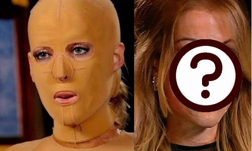 人太正遭嫉恨！毀容女復健2年脫面罩還是一樣正 嫉妒、縱火、焚身、毀容、女性