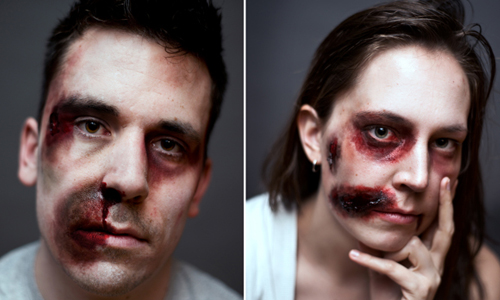 愛一個人錯了嗎？特效化妝重現俄羅斯反同志暴力慘況 From Russia Without Love、gay propaganda、Jamo Best、加拿大、攝影、反同、LGBT、同性戀、俄羅斯、多元成家、跨性別