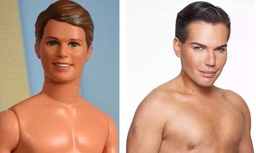 整型整到跟肯尼撞臉？巴西男追求完美挨刀上百次 Rodrigo Alves、真人、肯尼、塑膠、追求完美