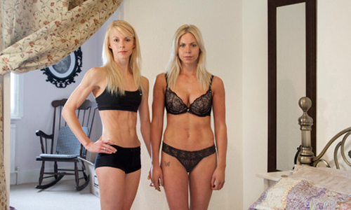 隆乳抽脂、變性有錯嗎？攝影師拍出年輕男女追求心中完美的一面 Michelle Sank、攝影、變性、厭食、抽脂、女、年輕、男、同志、隆乳、豐唇、肉毒、審美、流行、文化、青少年、藝術