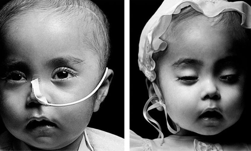 最接近死神的時刻！攝影師拍下人臨終前＆剛過世模樣 攝影、Walter Schels、死亡、死神、Life Before Death