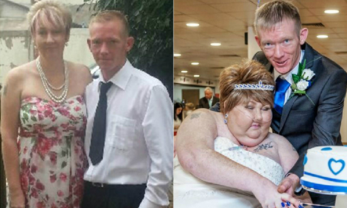 未婚妻癌末暴肥　短短10個月前後對比太令人心碎 感情、癌症、悲傷、感動、感人、感傷、腫瘤、病變、恐怖、肥胖、疾病、病、醫療、生病、患病、罹病、醫師、醫生、醫院、醫學、暴肥、男朋友、女朋友、男女、男女朋友、未婚妻、未婚夫、準新郎、準新娘、英國、腦部、腦、Jackie Malton