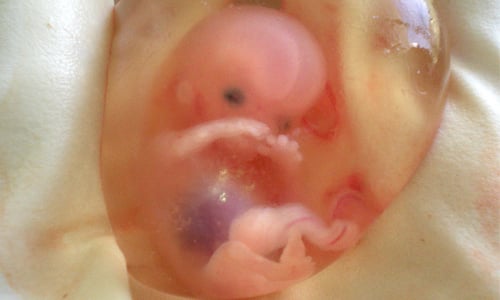 這款代誌甘無摳零？「史上最年輕媽媽」剛出生就懷雙胞胎！？ 年輕、媽媽、母親、懷孕、雙胞、雙胞胎、雙子、女孩、女嬰、女娃、離奇、醫學、醫療、醫生、醫師、醫院、吃驚、訝異、驚訝、驚駭、怪異、胎內胎、胎兒、胚胎、中國、香港、寄生、流產